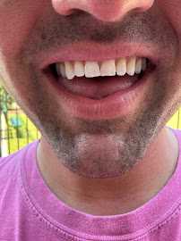 Apex Dental