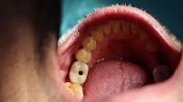 Shine Dental