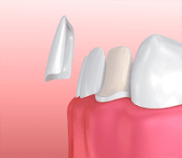 Le Dentalis