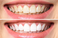 Smile Arts Dental