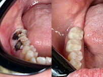 Frankford Dental Care