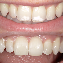 Quaker City Dental