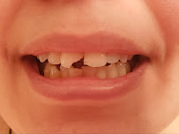 Aspen Dental - Pittsburgh, PA - North Hills