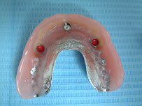 Anick Cyr Denturologiste Chicoutimi