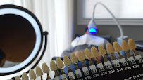 Teeth Whitening by Rochelle