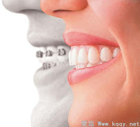 Gabrielle Bernard orthodontiste