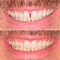 Charles Calhoun DDS