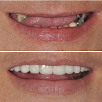 Dora Álvarez Odontología Integral - dentista en Colombia (Medellín)