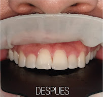 Dr Andres Alvarez Implantologo oral y Rehabiltacion