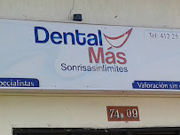 Bioestética Dental