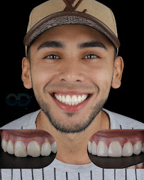 BeSmilet | Dra. Daniela Betancur
