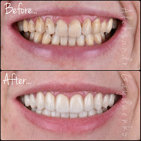 City Smile стоматологічна клініка