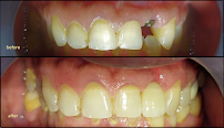 THE DENTAL EXCELLENCE | Dr. Uttom PhD, MSD, BDS