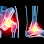 London Sports Injury Clinic