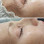 Timeless Beauty Laser & Anti-Aging Solutions