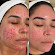 MM SKINCARE + ACNE CLINIC