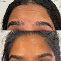 Barbara Mendoza Medical Aesthetician