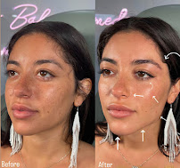 Perfect Aesthetics & Spa
