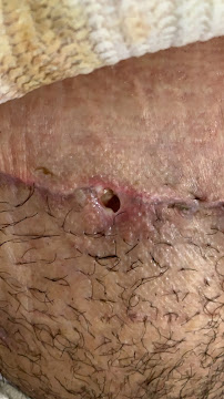 Pure Plastic Surgery