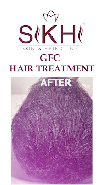 Skinvy Skin, Hair & Aesthetic Clinic | Best Dermatologist in Hyderabad, KPHB | Lady Skin Specialist | Hair Loss Treatments