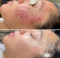 Skin Spa Utah