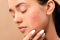 Aviva Cosmetic and Laser Clinic