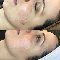 Victoria Park Medispa - Toronto Bay