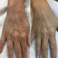 Victoria Park Medispa - Toronto Bay