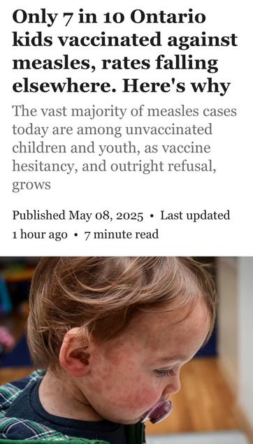 Only 7 in 10 Ontario
kids vaccinated against
measles, rates falling
elsewhere. Here's why
The vast majority of measles cases
today are among unvaccinated
children and youth, as vaccine
hesitancy, and outright refusal,
grows
Published May 08, 2025