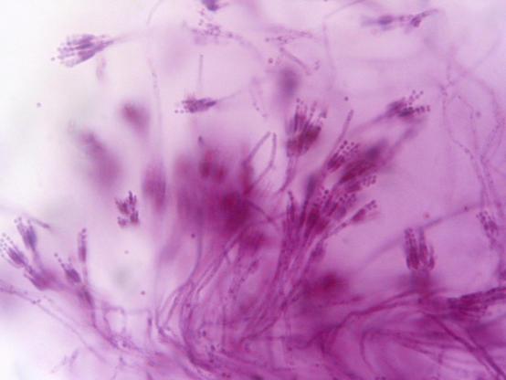 Image of Penicillium, the taxon in which the compound is found.