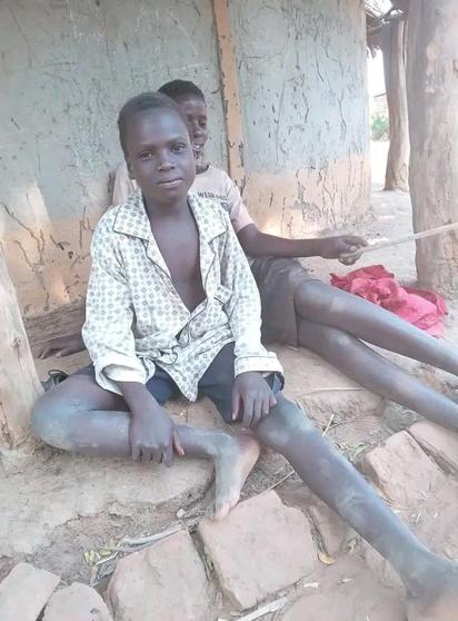 A child looking un health in Nswazi community