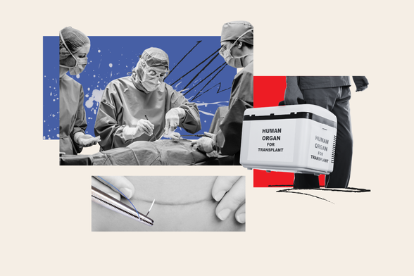 Organ Procurement and Transplantation